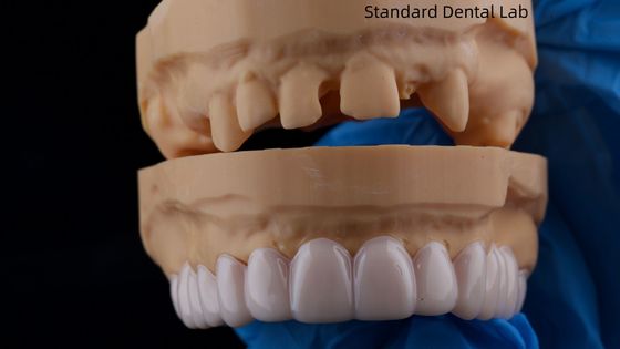 comprar Alta estética Dental Snap On Smile Dental Laboratorio estándar Aplicación dental extraíble fabricación en línea