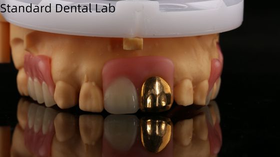 comprar Dentaduras de acrílico completo con dientes de oro amarillo/dentaduras temporales con dentaduras de acrílico Ivoclar profesional aprobado por la FDA fabricación en línea