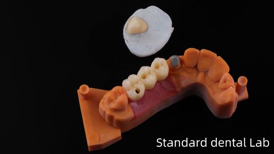 comprar Laboratorio dental de post núcleo de China / metal post núcleo con corona PFM fabricación en línea