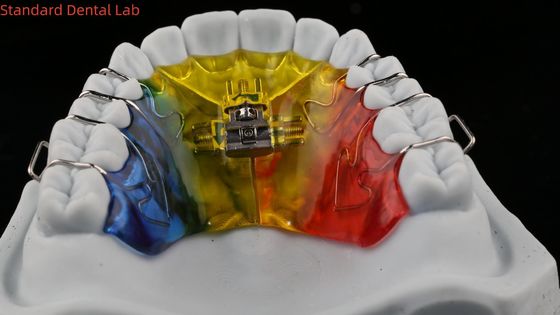 comprar Dientes de expansión y desestalización ortodoncista paladar expandir China laboratorio dental fabricación en línea