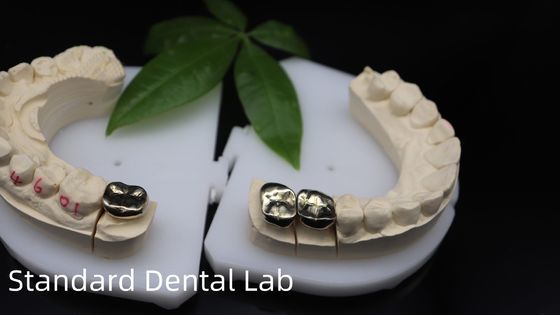 comprar Profesional ISO y FDA aprobado Corona de oro amarillo para laboratorio dental Envío UPS o Fedex Tiempo de producción 2 días fabricación en línea