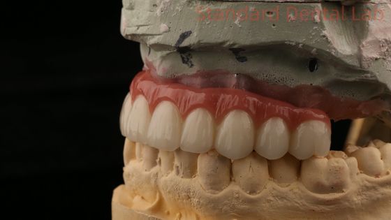 comprar Coronilla de implantes dentales con tornillo de titanio híbrido todo en 4 puente de implantes dentales de zirconia fabricación en línea