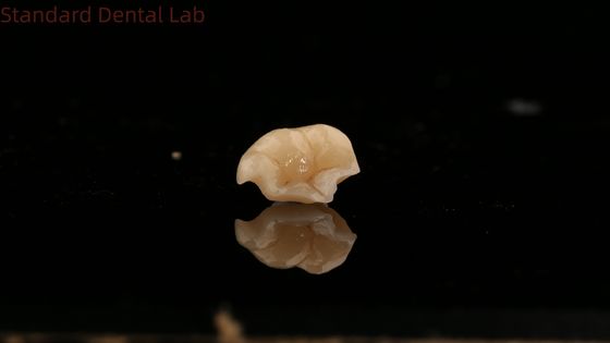 comprar Fortaleza Emax Coroneta de cerámica con excelente resistencia a las manchas China Dental Lab fabricación en línea