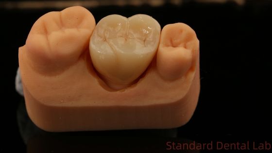 comprar Molino y centro de la corona de zirconio, China laboratorio dental entrega rápida fabricación en línea