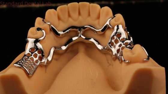 comprar Cuadro de metal fundido superior Dentes parciales fuertes Ligero y duradero fabricación en línea