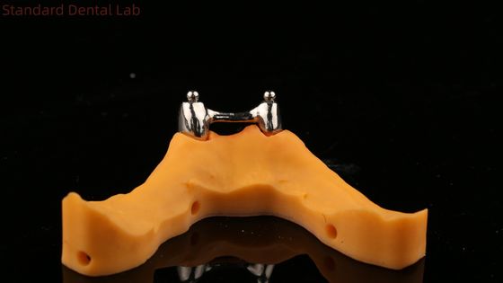 comprar Ivoclar Digital Dental Implant Bar Denture con accesorios, Dentures con apoyo de implantes de titanio acrílico completo fabricación en línea