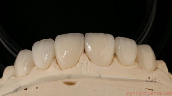 comprar Puente de la corona de zirconio de precisión ajuste cómodo / estética 3-4 días Tiempo de respuesta rápido fabricación en línea