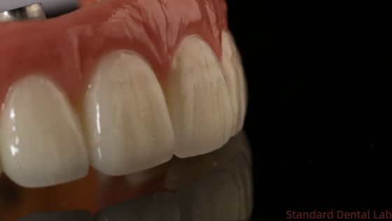comprar Implante dental de zirconio profesional corona de titanio CAD CAM corona de zirconio China laboratorio dental fabricación en línea