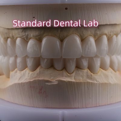 Laboratorio dental Arco completo de zirconia Coronas de porcelana PFZ Corona ISO FDA CE