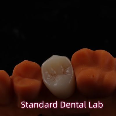 Alta estética BrusZir de contorno completo Coroas de zirconia Puente PFZ