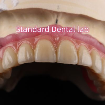 Cementos rápidos y productos para implantes dentales de zirconia