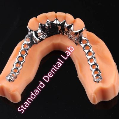 Impresión láser Cobalto Cromo Marco de metal Dentadura parcial Ni estar libre