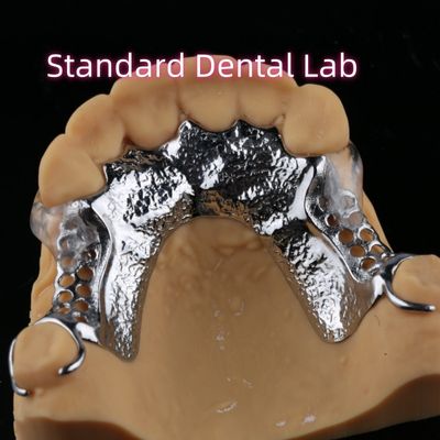 Impresión láser Dentadura parcial de cobalto cromo con pinzas transparentes