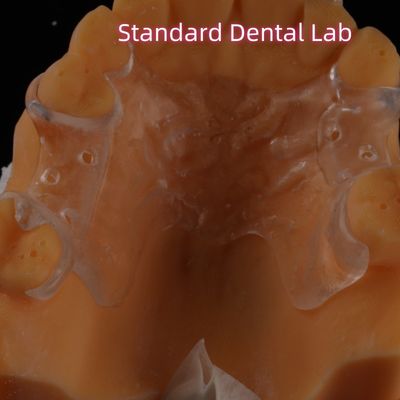 Las clavijas de dentaduras parciales acrílicas transparentes removibles conservan el aspecto natural