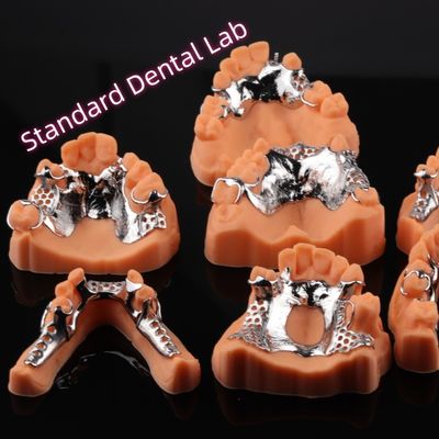 CAD CAM Cuadro de metal de prótesis parcial extraíble 3Forma Diseño de prótesis exocad