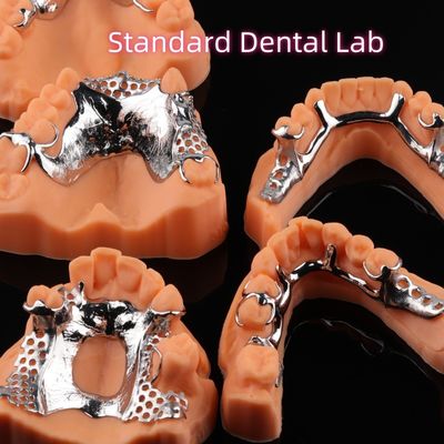 Dentadura CoCr Impresa Esqueleto Diseño de Dentadura Parcial de Metal Cromo