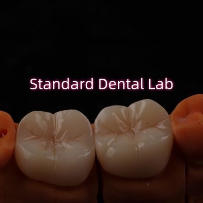 Laboratorio Dental de Bruxier de contorno completo de zircónia monolítica de Crown Bridge