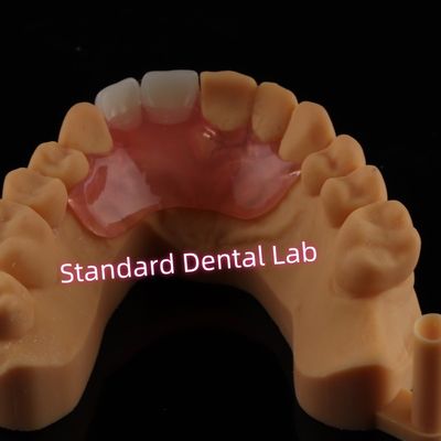 Dental Valplast Flexible Dentadura de aletas Dentadura parcial extraíble