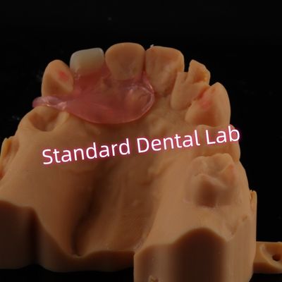 Dentes parciales de un diente flexible extraíble
