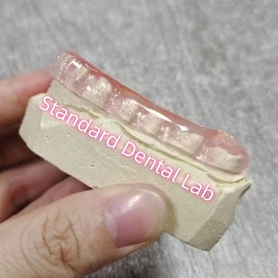 Bruxismo Dental Oclusal Flanca de la Guardia Nocturna Laboratorio Dental Estándar
