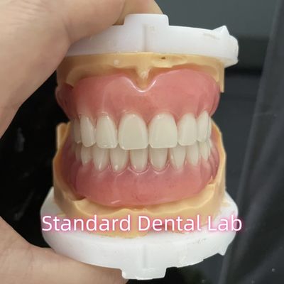 Laboratorio dental estándar de OEM Dentes removibles completos fáciles de tomar y sacar