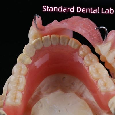 Restauración dental extraíble Dentes de dentadura parcial acrílica con pinzas de alambre