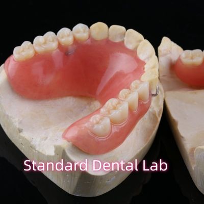 Dentadura parcial acrílica de alta estética Dentadura dental de resina con base