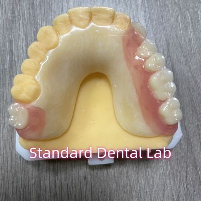 OEM Sombra de dientes fundidos extraíbles Dentadura parcial acrílica con pinzas