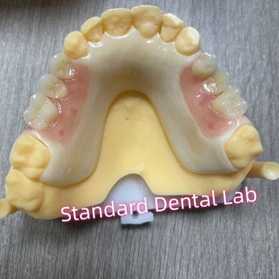 Cuadro acético de la sombra de los dientes superiores cerradura acrílica dentadura parcial extraíble