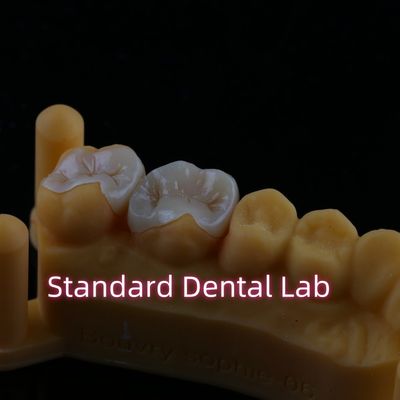 Resina compuesta Zirconia Emax Metal Inlay Revestimiento de recubrimiento
