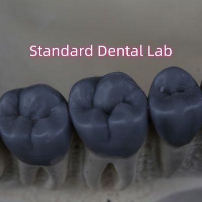 El laboratorio dental digital profesional de cera de 3 formas aprobado por la FDA