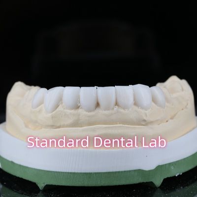 Dentistería de diagnóstico y restauración con cera para carillas de alta estética