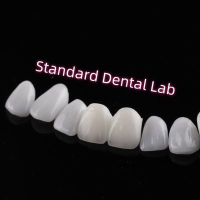Resistencia a la abrasión Emax Zirconia carillas laminadas Translucidez incisiva