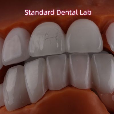 Capa de litio Dicilicate Ivoclar Emax Zirconia carillas laminadas translúcidas OEM ODM