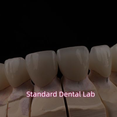 Puente de cerámica de zircónia con incisión translúcida de PFZ Dental