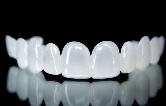 Dispositivo para el diseño dental de carillas blancas de nieve