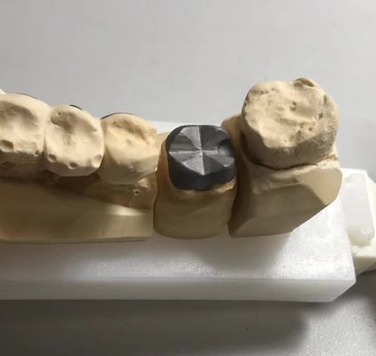 ISO FDA CE Dental Metal Post y el núcleo de la corona PFM Bien ajustado