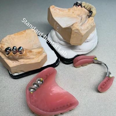 Alta estética CAD CAM Diente de reemplazo de prótesis parciales de adherencia de laboratorio dental estándar
