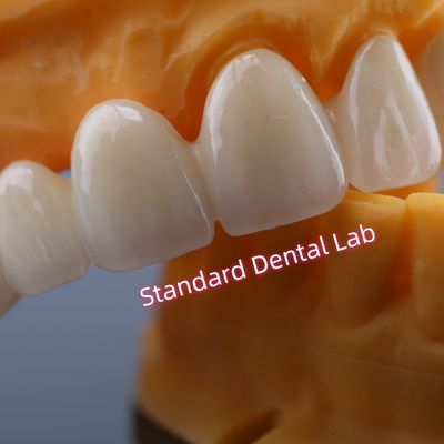 CAD CAM Molino de zircón Puente de corona muy biocompatible