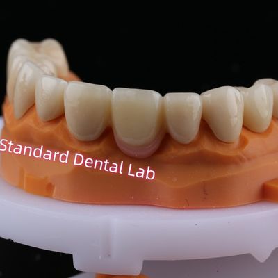 Digital CAD CAM fresado de zirconia de puente en capas con corona de porcelana rosa