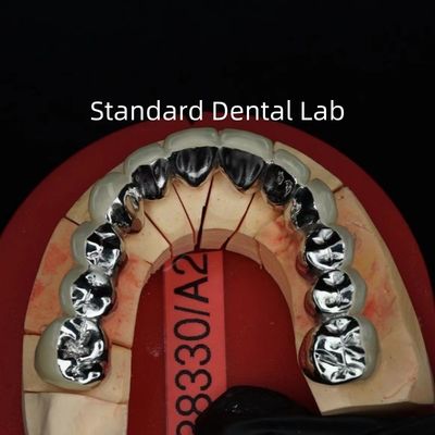 Coronas de porcelana de metal de arco completo / puente de corona dental PFM estética precisa
