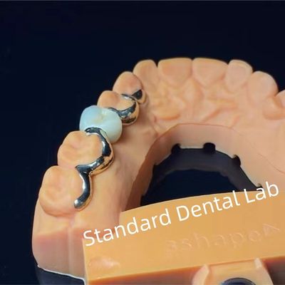 Dientes dentales PFM Puente de Maryland Alta estética Certificado FDA