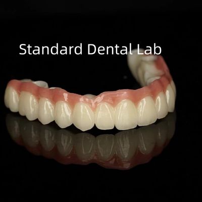 Estética Porcelana monolítica Corona de zirconia Translucidez de arco completo