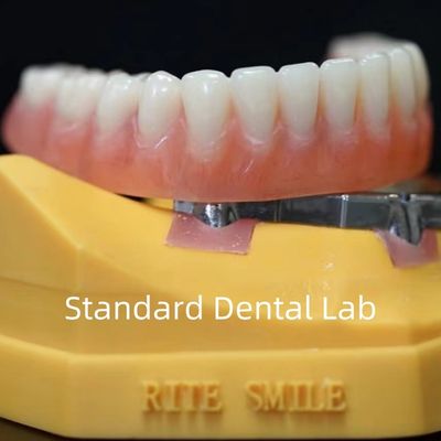 Dentaduras con apoyo de implantes de titanio Dentaduras de precisión Ivoclar sobre implantes ISO FDA CE