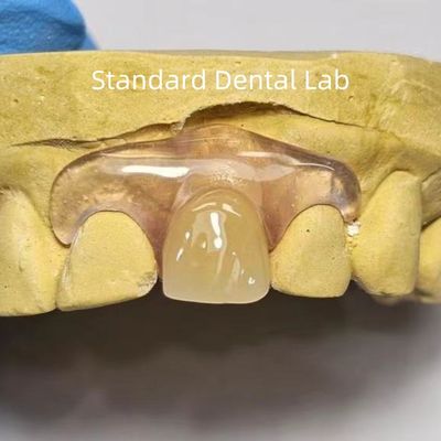 Dental TCS Valplast Flexible Dentaduras parciales resistentes a los olores de decoloración
