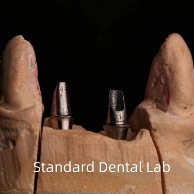 Porcelana Dental Circonia Implante Corona Profesional Alta Estética
