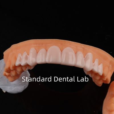 Alta estética dental en el laboratorio dental estándar de sonrisa