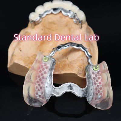 Apego de precisión extraíble Nueva dentadura parcial de Ace Valplast rosa / oscuro