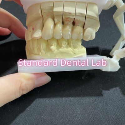 Fusionado PFM no precioso CoCr Metal Puente de porcelana Dental CCM