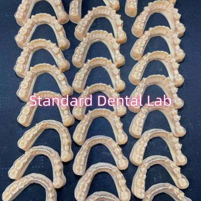 Plan de tratamiento de los dentistas profesionales ortodoncia invisalign de retención clara